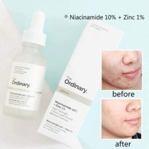 The-Ordinary-Niacinamide-10-–-30ml-without-Batch-Code main
